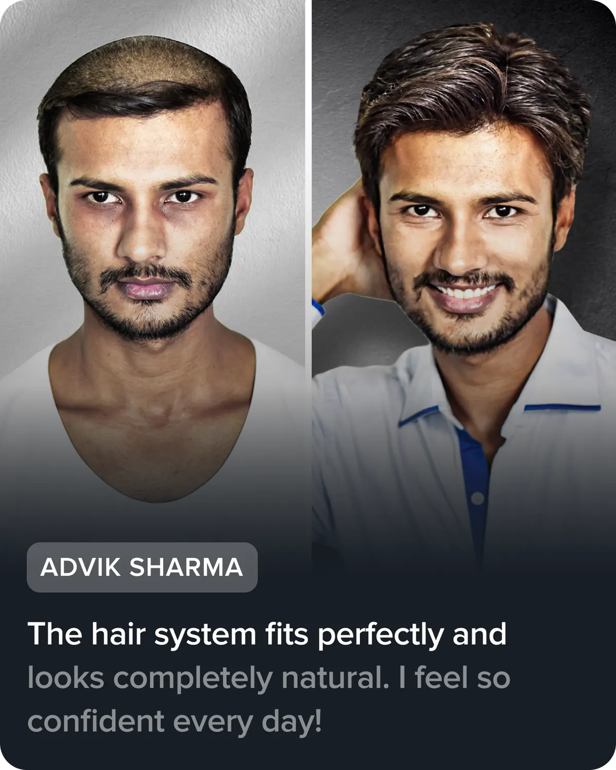 Advik Sharma, before and after his hair system. He says: “The hair system fits perfectly and looks completely natural. I feel so confident every day!”