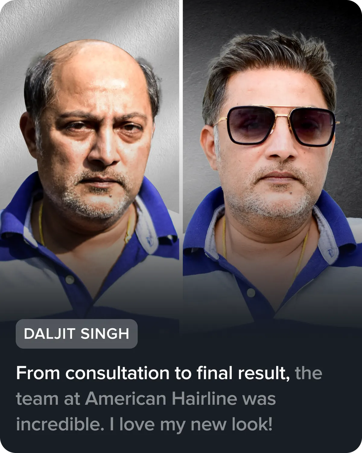 Daljit Singh, before and after his hair system. He says: “From consultation to final result, the team at American Hairline was incredible. I love my new look!”