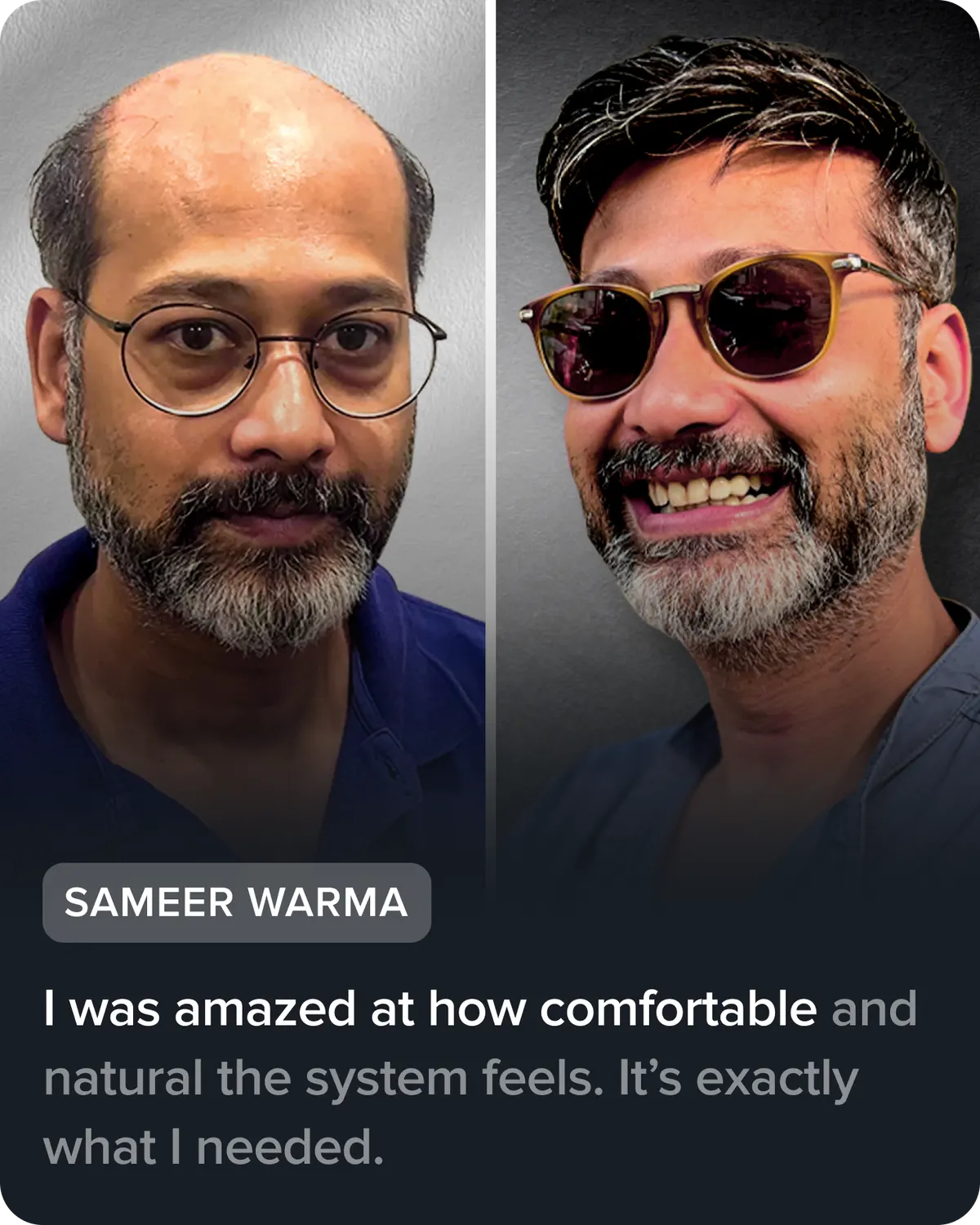 Sameer Warma, before and after his hair system. He says: “I was amazed at how comfortable and natural the system feels. It’s exactly what I needed.”