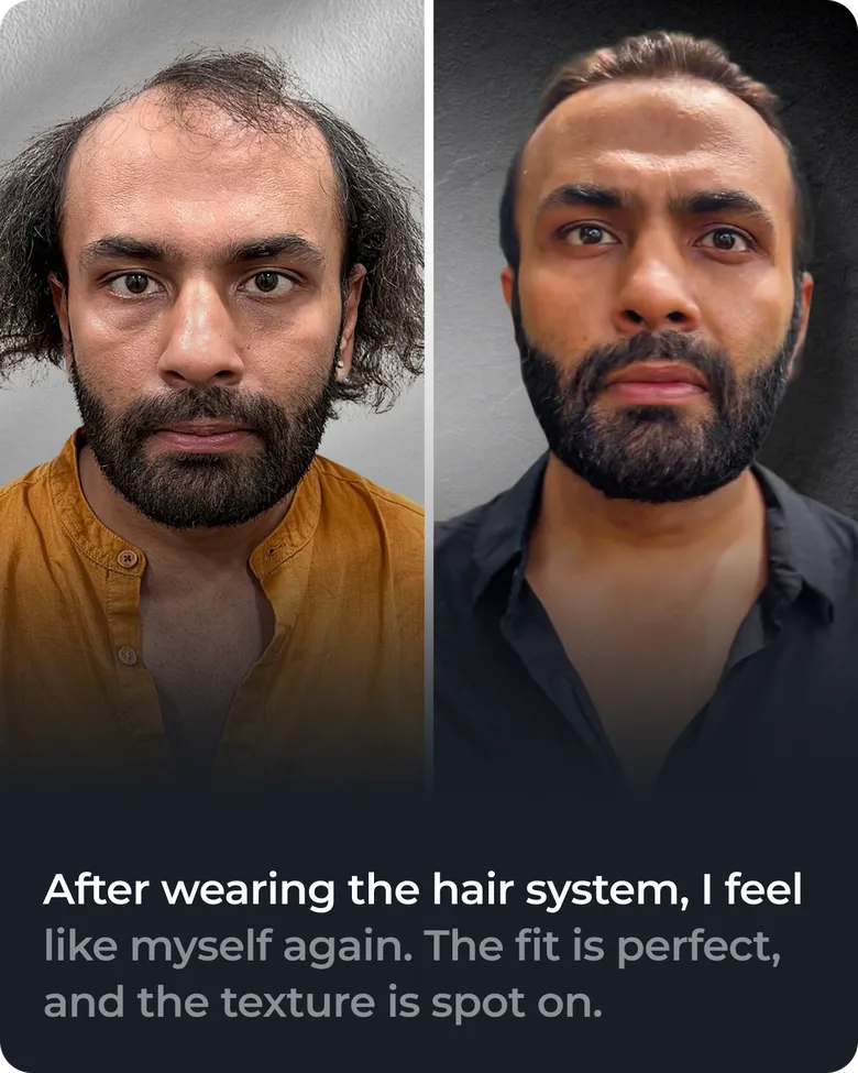 Hair system client transformation