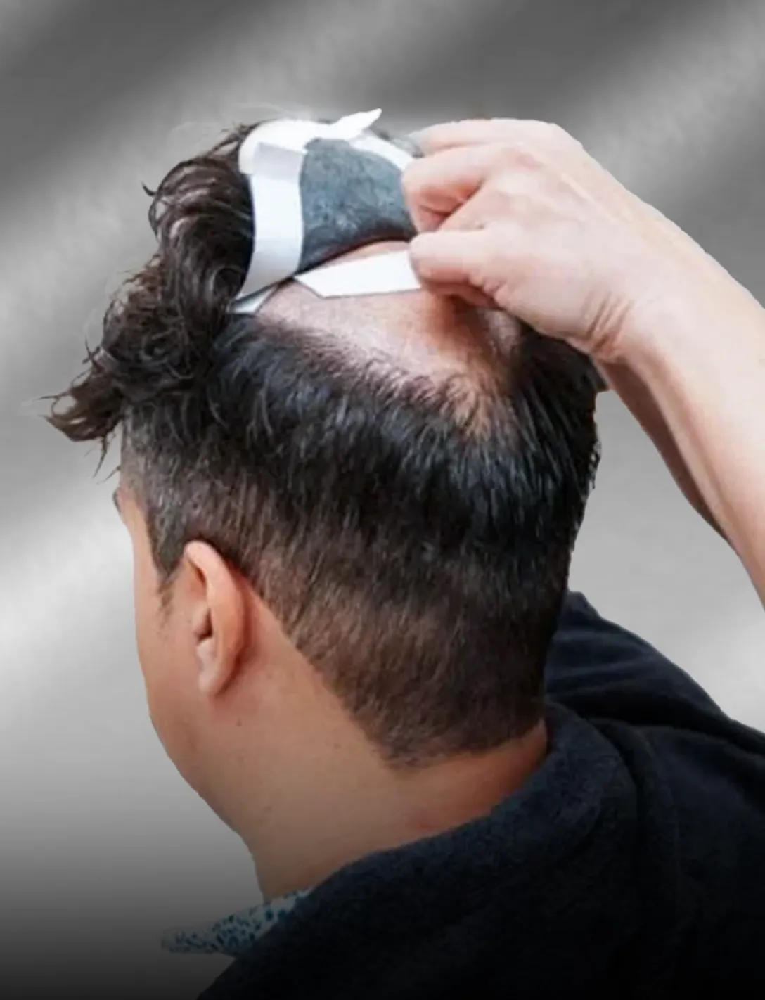 A hair system being fitted to a client's crown.