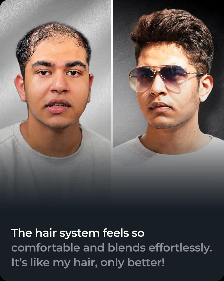 Stick-on hair system client transformation