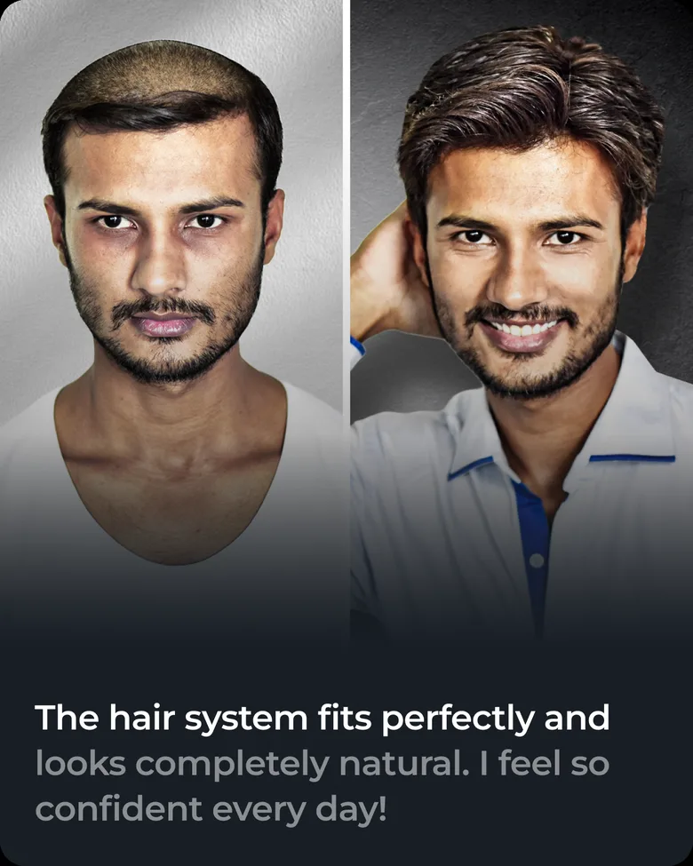 Stick-on hair system client transformation
