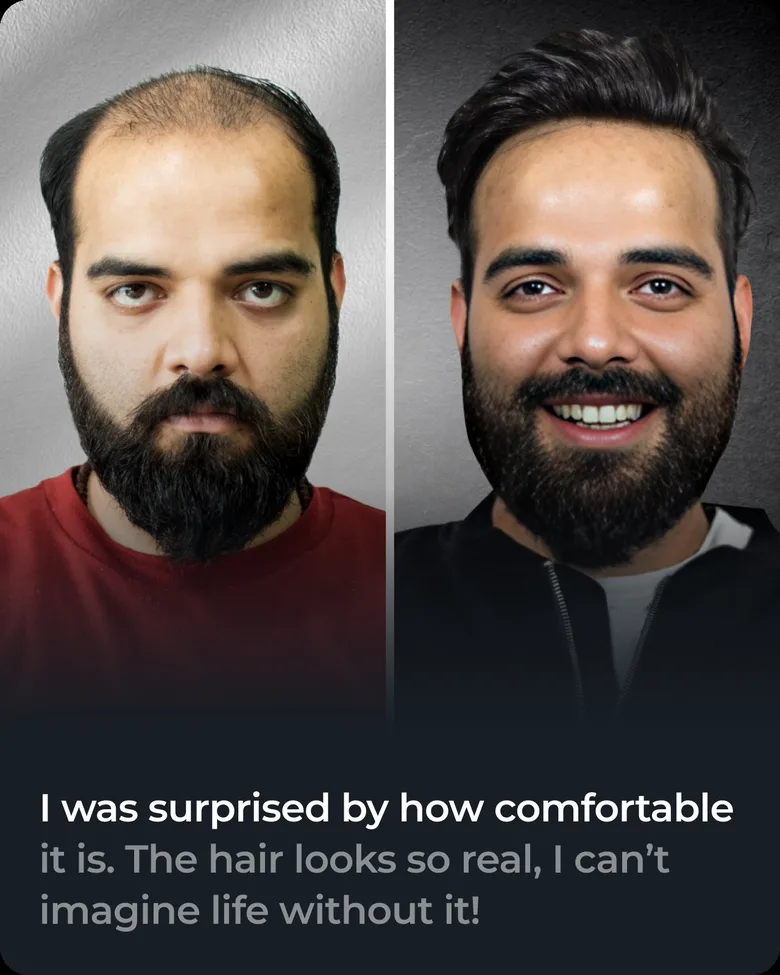 Stick-on hair system client transformation