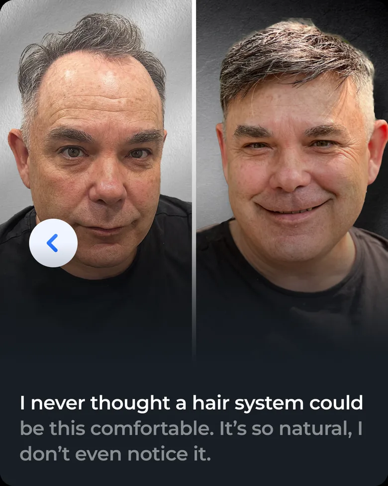 Stick-on hair system client transformation