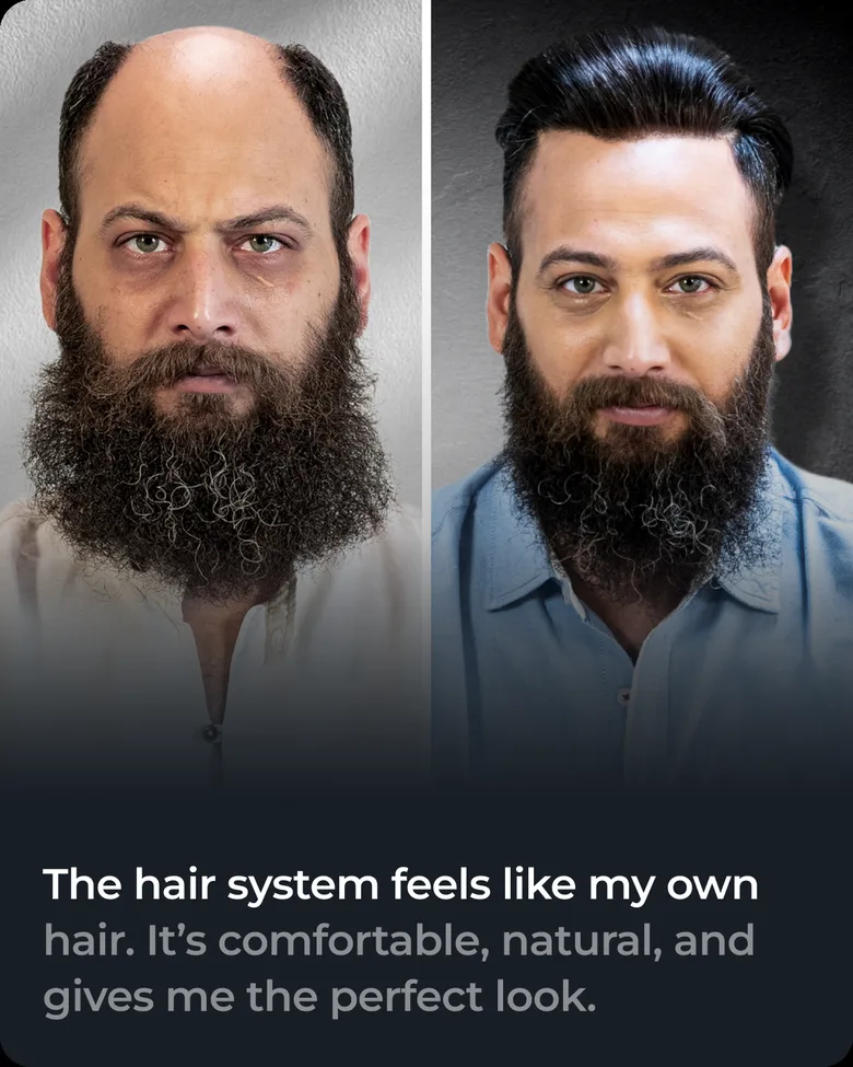 Stick-on hair system client transformation